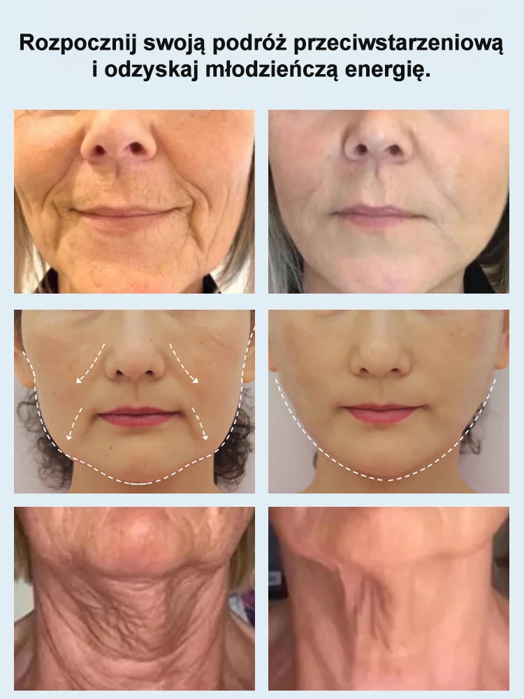 🧴Najlepszy krem ​​przeciwzmarszczkowy! Ujędrnia i rozjaśnia skórę w 7 dni, efekt rozjaśnienia i wybielenia 96,8%