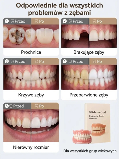 🦷Bezklejowe protezy próżniowe, w 100% mocne i trwałe, natychmiast przywracają naturalnie wyglądające zęby.