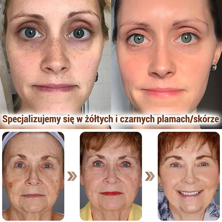 ✨Ulepszona maska ​​kolagenowa Gold: Natychmiastowe wybielanie z efektem peel-off, redukcja drobnych zmarszczek w 15 minut