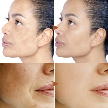 ✨Ulepszona maska ​​kolagenowa Gold: Natychmiastowe wybielanie z efektem peel-off, redukcja drobnych zmarszczek w 15 minut