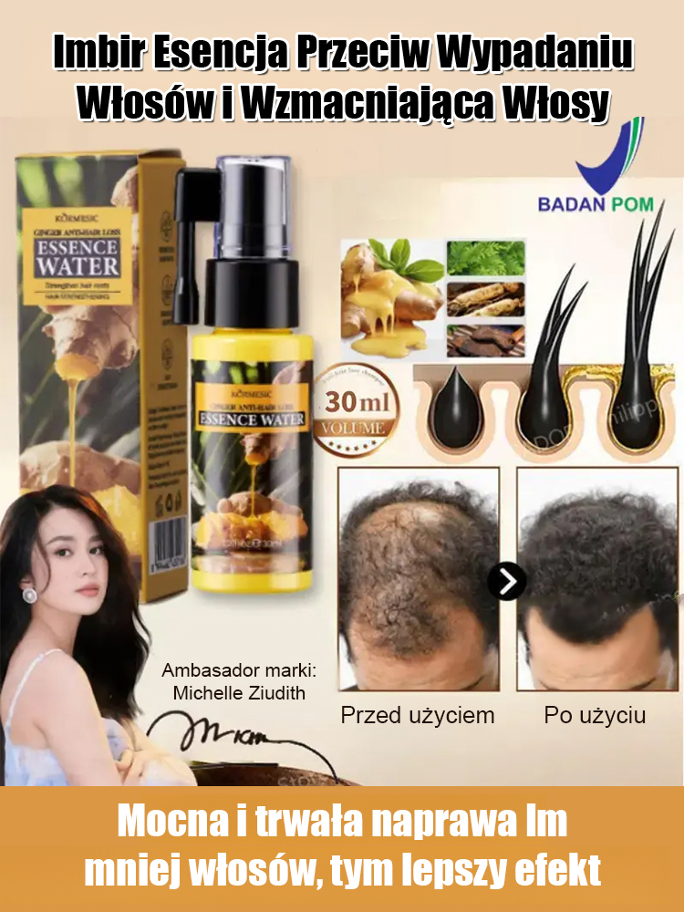 🌱Esencja imbirowa przeciw wypadaniu włosów | Aktywuje mieszki włosowe • Wspomaga wzrost nowych włosów w 15 dni