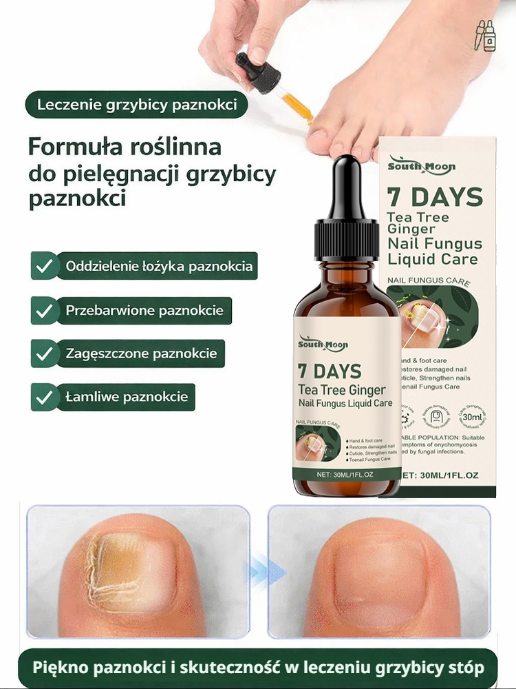 💅Roztwór do leczenia grzybicy paznokci｜🌿Drzewo herbaciane + imbir głęboko regeneruje łożysko paznokcia, odpowiedni do dłoni i stóp