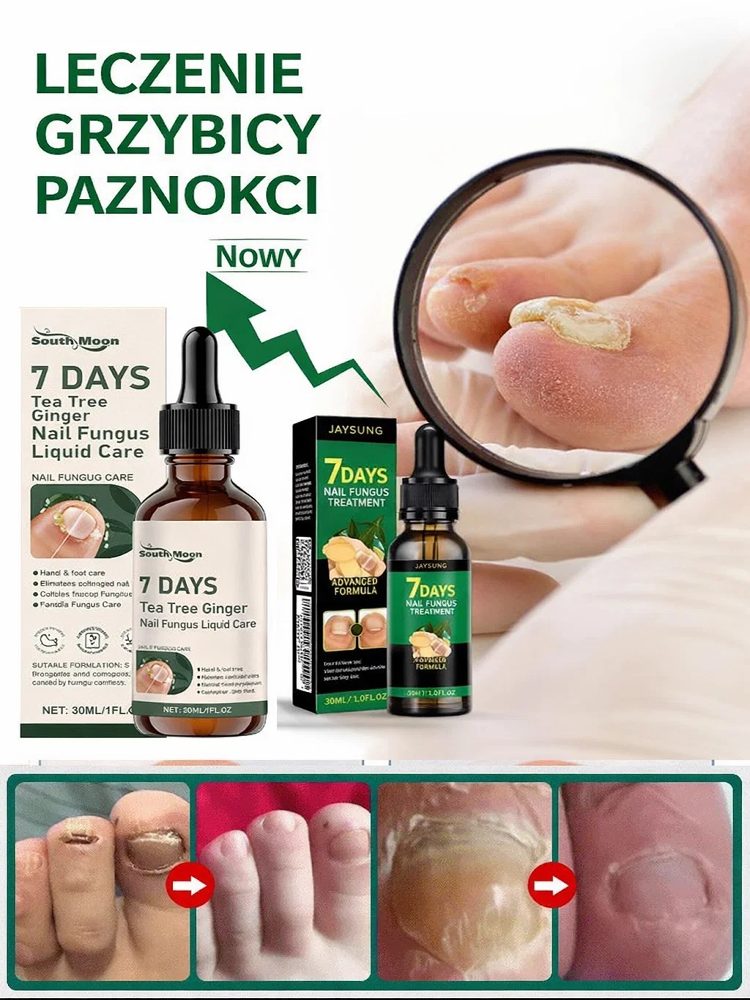 💅Roztwór do leczenia grzybicy paznokci｜🌿Drzewo herbaciane + imbir głęboko regeneruje łożysko paznokcia, odpowiedni do dłoni i stóp