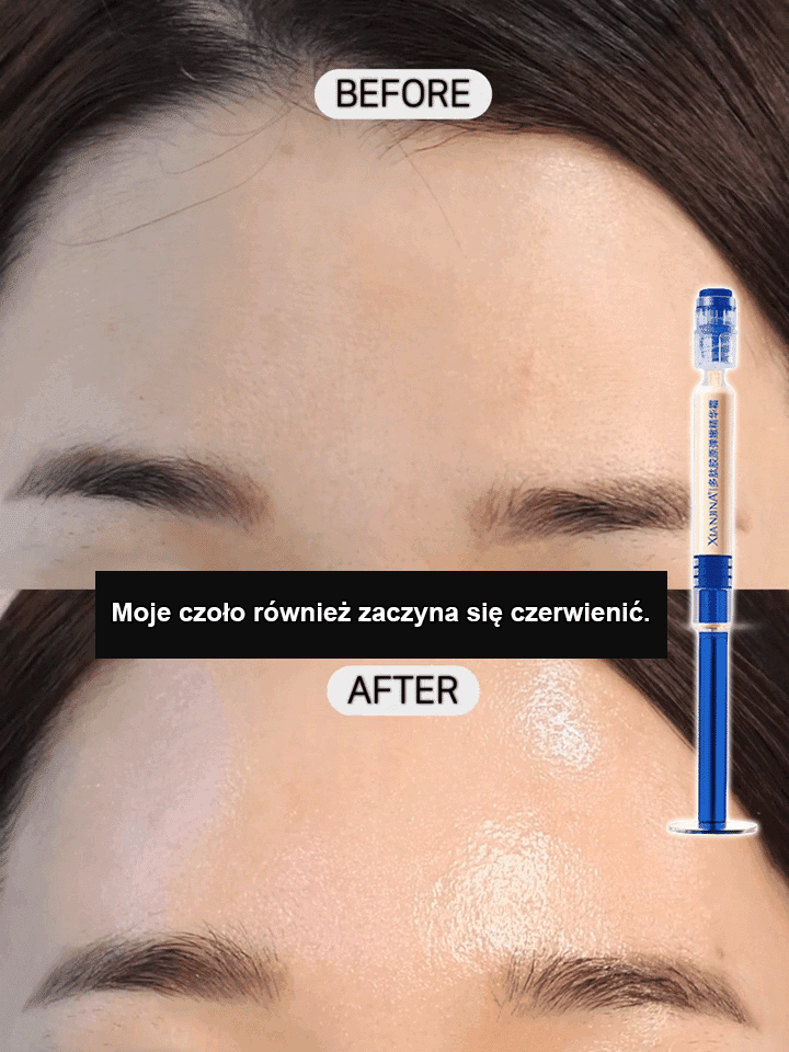【💫Kup jeden, a dostaniesz dwa】Esencja kolagenu peptydowego🤩 Redukuje zmarszczki na czole w 7 dni, redukuje drobne linie wokół oczu w 14 dni🌿