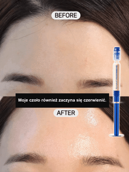 【💫Kup jeden, a dostaniesz dwa】Esencja kolagenu peptydowego🤩 Redukuje zmarszczki na czole w 7 dni, redukuje drobne linie wokół oczu w 14 dni🌿