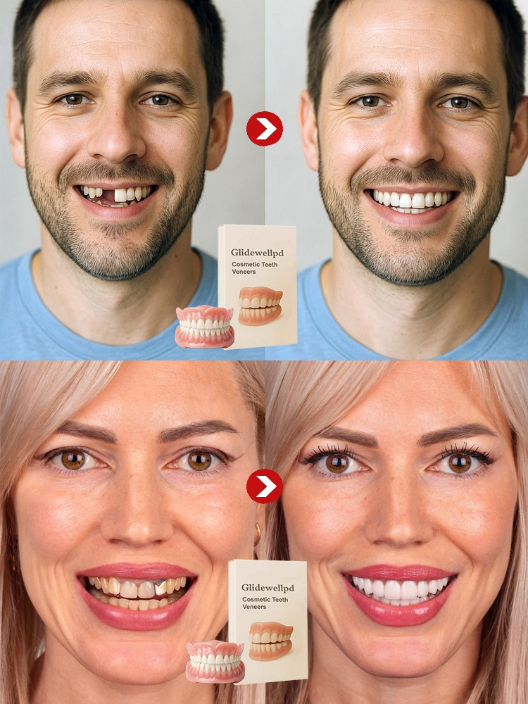  [Epic Upgrade] Premium Full Cover Dentures, Ditch Loose, Bulky Dentures! Get a Flawless Full-Arch Smile With Our Epic Suction Tech.