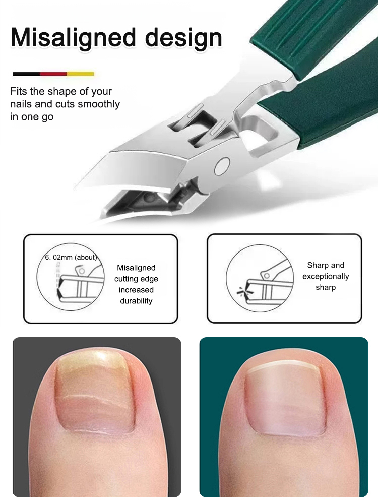 Easily trim ingrown t💥Nail clipping is no longer a pain! This 3-piece anti-splash nipper set is the ultimate tool I'll keep using! 🔸 Wide-opening design: The wide opening accommodates thick and tough nails, provides a firm grip, and makes cutting easy. 