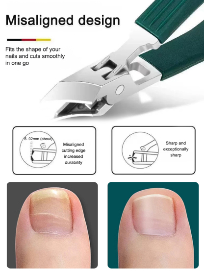 Easily trim ingrown t💥Nail clipping is no longer a pain! This 3-piece anti-splash nipper set is the ultimate tool I'll keep using! 🔸 Wide-opening design: The wide opening accommodates thick and tough nails, provides a firm grip, and makes cutting easy. 