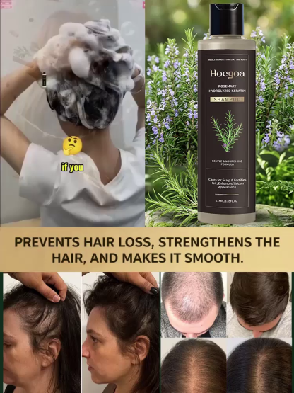 🌿⚡ Revitalize Your Roots & Stop Hair Loss! Experience Deep Herbal Nourishment in Every Wash!