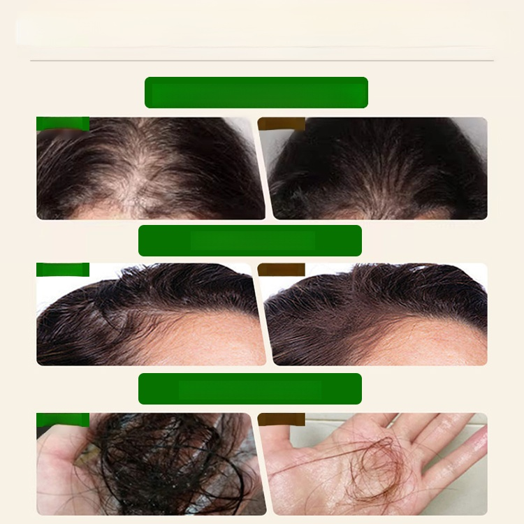 😴 Say goodbye to limp locks and hello to INSTANT FULLNESS with our miracle hair growth essential oil! 💥