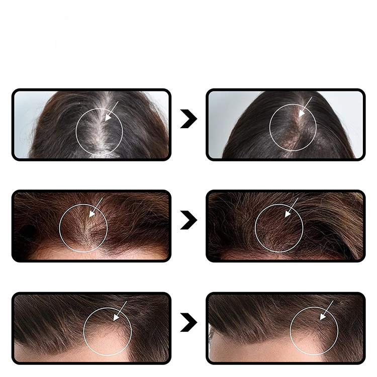 Batana Oil for Strengthening Hair and Preventing Hair Loss. Ditch Thinning Hair! Wake Up Dormant Follicles and Regrow Thick, Strong Strands Fast.