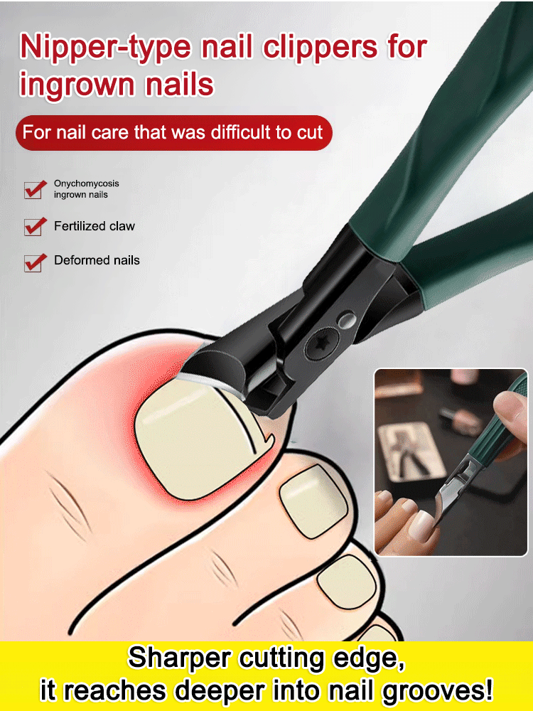 Easily trim ingrown t💥Nail clipping is no longer a pain! This 3-piece anti-splash nipper set is the ultimate tool I'll keep using! 🔸 Wide-opening design: The wide opening accommodates thick and tough nails, provides a firm grip, and makes cutting easy. 