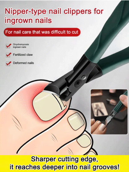 Easily trim ingrown t💥Nail clipping is no longer a pain! This 3-piece anti-splash nipper set is the ultimate tool I'll keep using! 🔸 Wide-opening design: The wide opening accommodates thick and tough nails, provides a firm grip, and makes cutting easy. 
