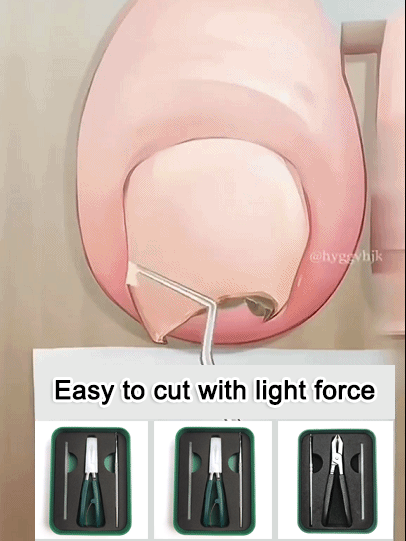 Easily trim ingrown t💥Nail clipping is no longer a pain! This 3-piece anti-splash nipper set is the ultimate tool I'll keep using! 🔸 Wide-opening design: The wide opening accommodates thick and tough nails, provides a firm grip, and makes cutting easy. 