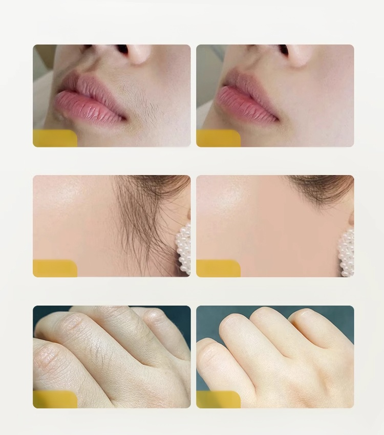 🪒99.9% of facial hair was removed. 1-second hair removal, no pain, any area! Buy 1, get 1 free! 😌 Just rotate gently, smooth skin instantly – no pain guar