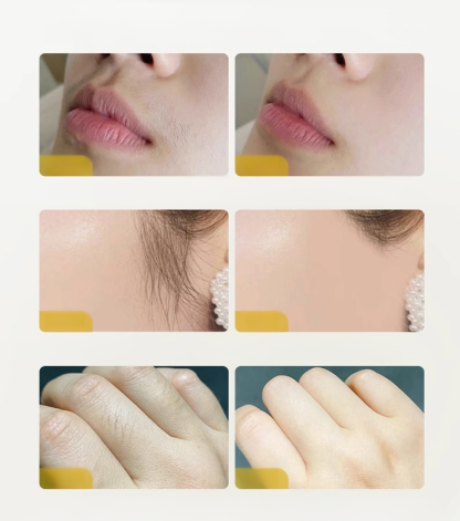 🪒99.9% of facial hair was removed. 1-second hair removal, no pain, any area! Buy 1, get 1 free! 😌 Just rotate gently, smooth skin instantly – no pain guar