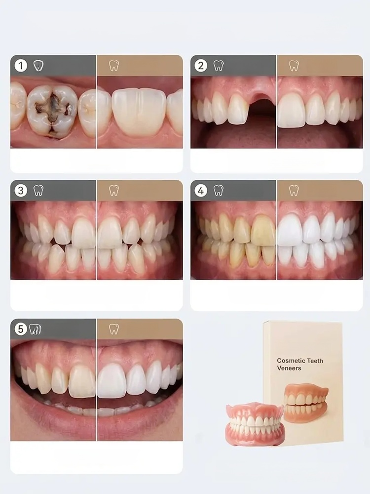  [Epic Upgrade] Premium Full Cover Dentures, Try our bespoke, feather-light teeth for a 100% natural smile! 30-Day Hassle-Free Return Policy — A completely risk-free trial experience!