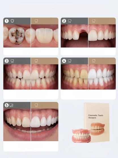  [Epic Upgrade] Premium Full Cover Dentures, Try our bespoke, feather-light teeth for a 100% natural smile! 30-Day Hassle-Free Return Policy — A completely risk-free trial experience!
