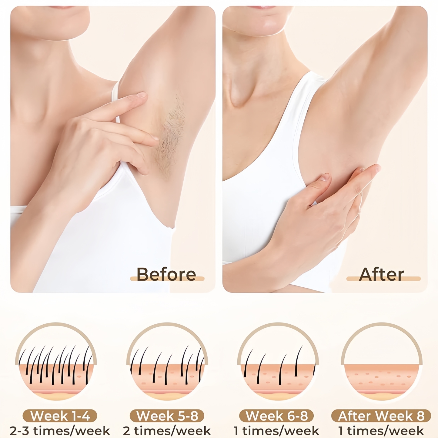 IPL Hair Removal Haven Pro