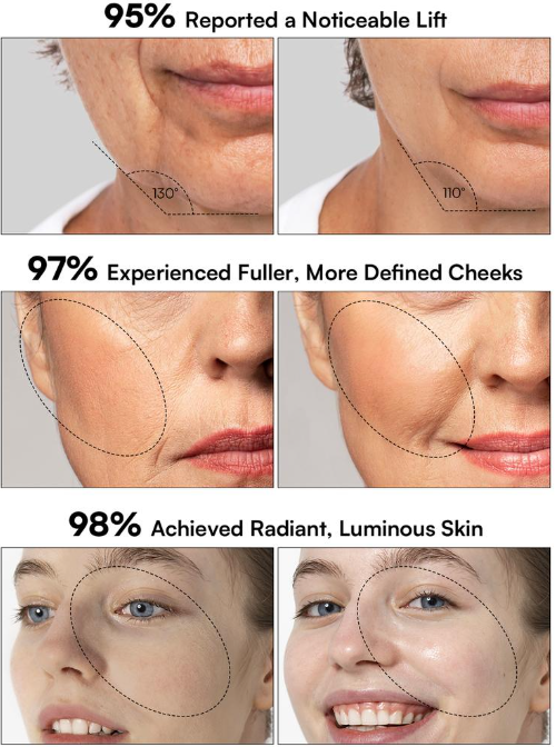Truvencare™ Flare Microcurrent Facial Device