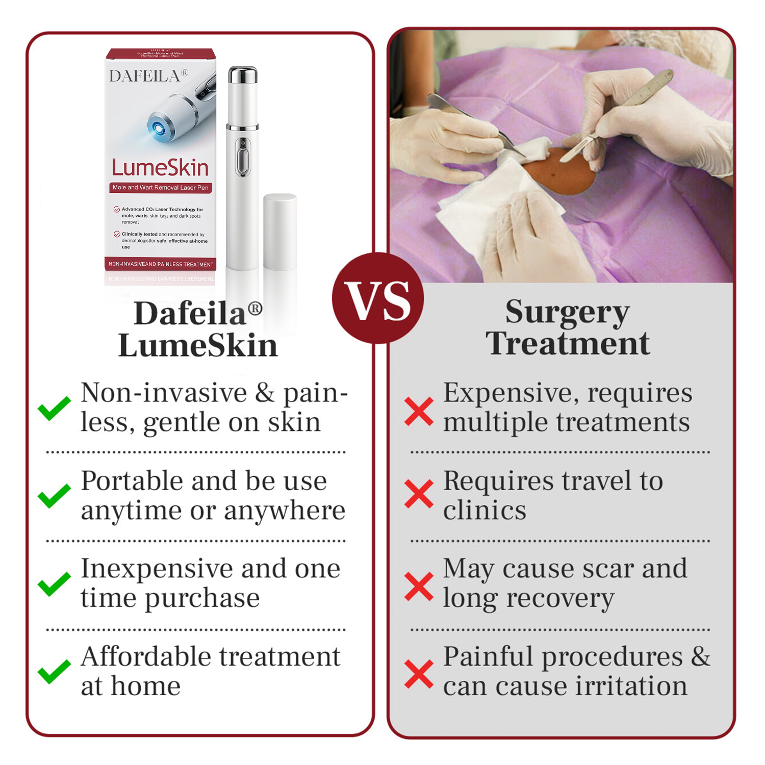 ❤Sugersuper® LumeSkin Mole and Wart Removal Laser Pen ❤️