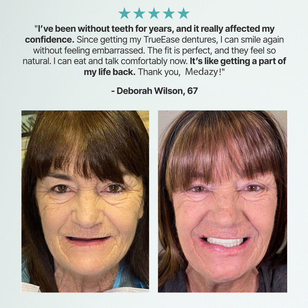 🌟🌟Ends Today: 67% OFF! Medazy? Custom-Fit Full Functional DenturesMake you more confident