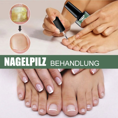 Flüssigkeit zur Behandlung von Nagelpilz