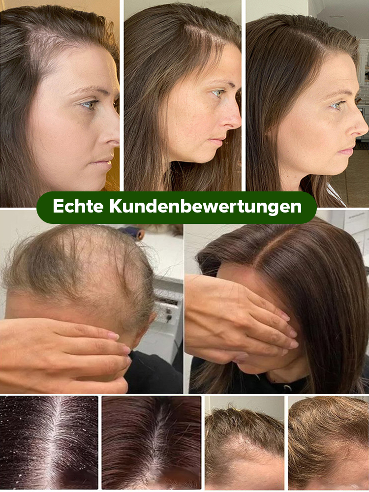 【7 Tage Haarwachstum】Bio-Rosmarin-Anti-Haarausfall-Shampoo