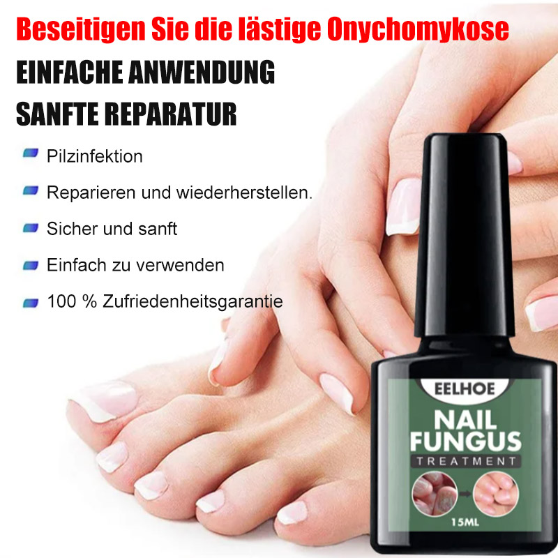 Flüssigkeit zur Behandlung von Nagelpilz