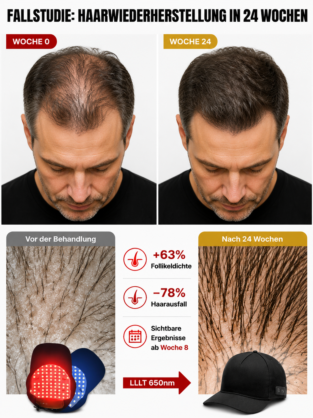 🧢 Klinisch getestete Kappe mit 272 Laserdioden – 650nm Dual-Therapie für volleres Haar in 6 Wochen, Heute 50% Rabatt + Risikofreie 30 Tage Geld-zurück-Garantie