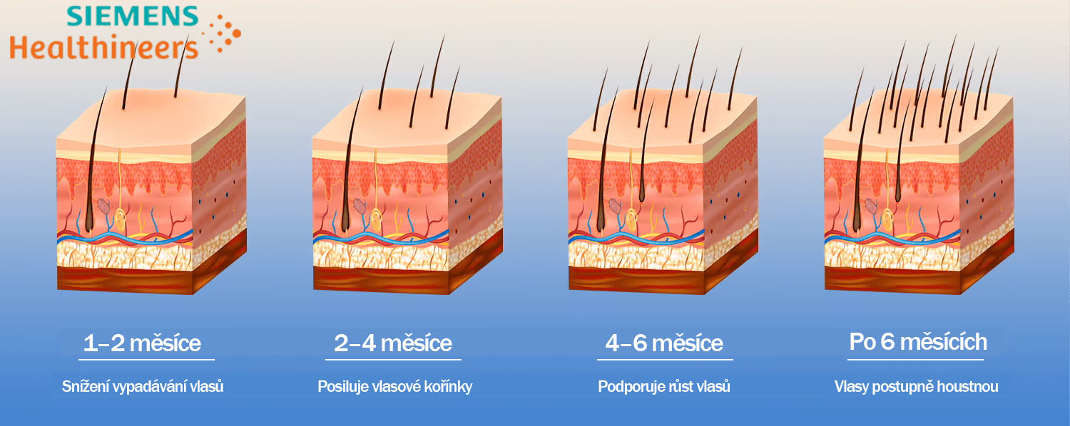 postup pro růst vlasů