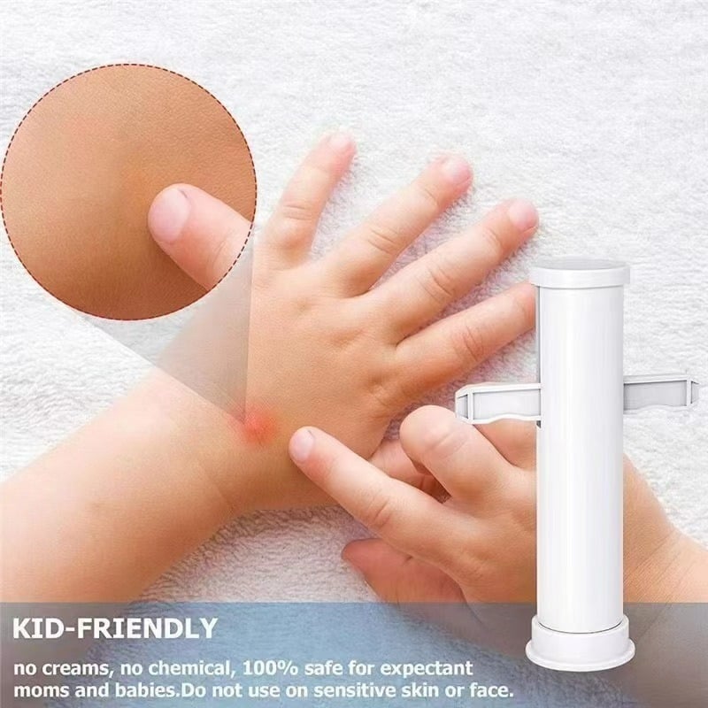 🔥Summer Hot Sale 55% OFF -🦟Bug Bite Suction Tool (Relieve itching and swelling✅)