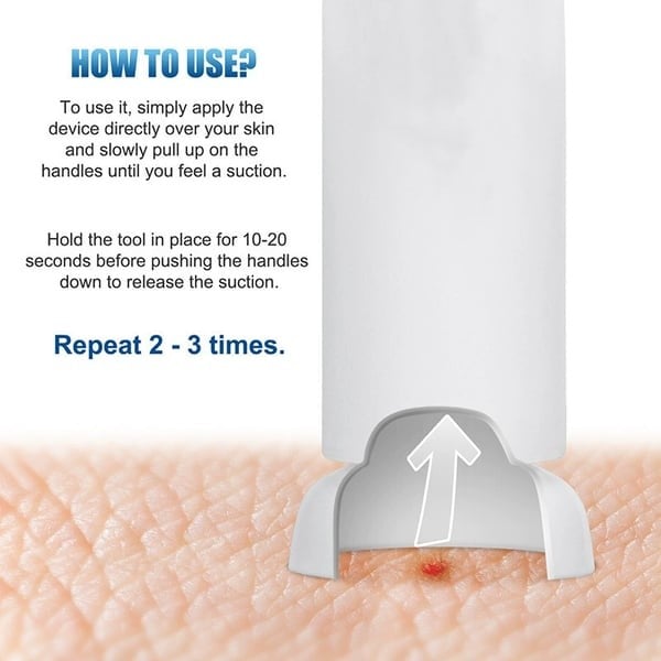 🔥Summer Hot Sale 55% OFF -🦟Bug Bite Suction Tool (Relieve itching and swelling✅)