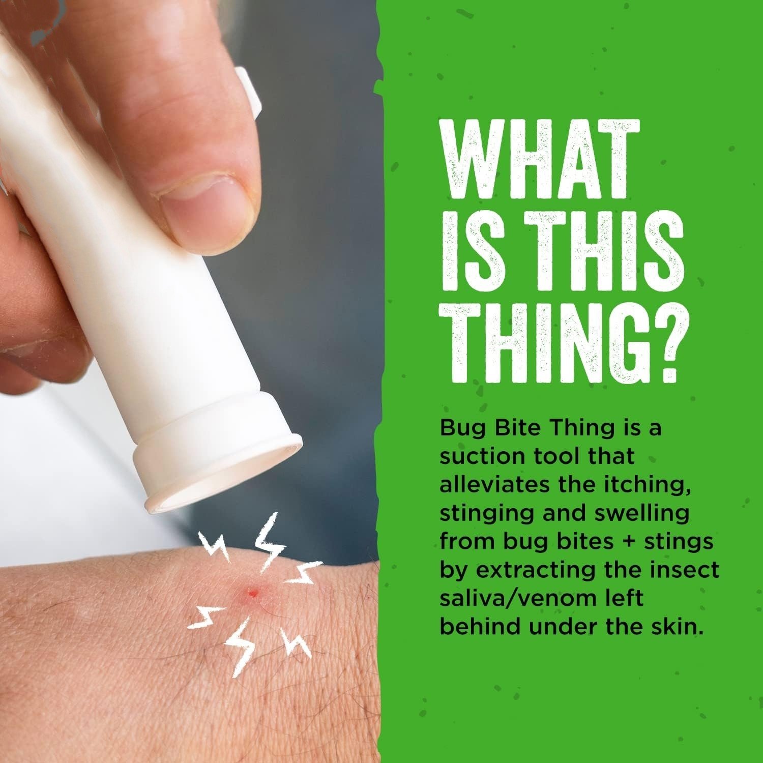 🔥Summer Hot Sale 55% OFF -🦟Bug Bite Suction Tool (Relieve itching and swelling✅)