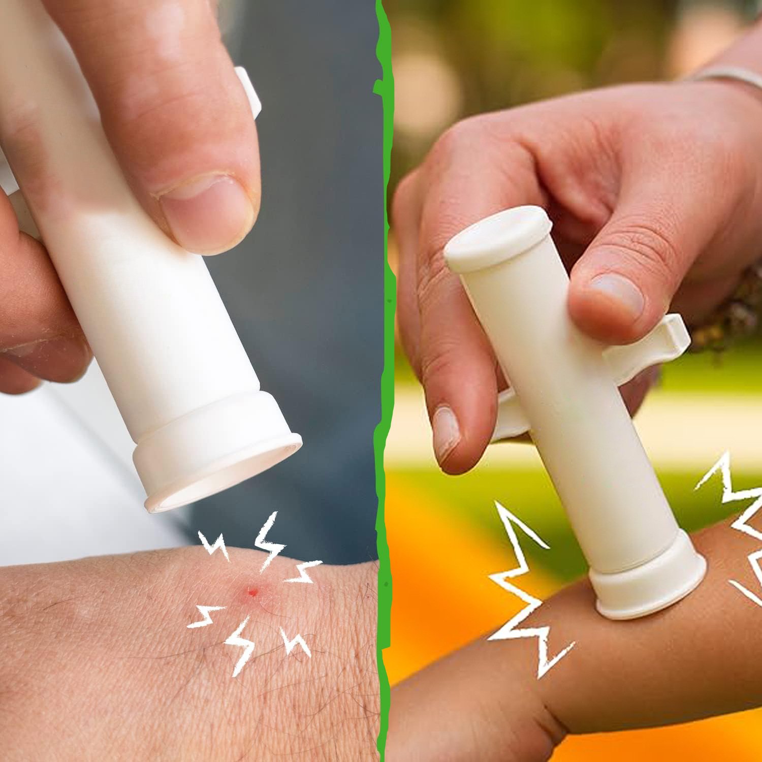 🔥Summer Hot Sale 55% OFF -🦟Bug Bite Suction Tool (Relieve itching and swelling✅)