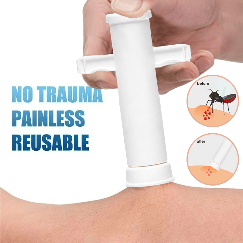 🔥Summer Hot Sale 55% OFF -🦟Bug Bite Suction Tool (Relieve itching and swelling✅)