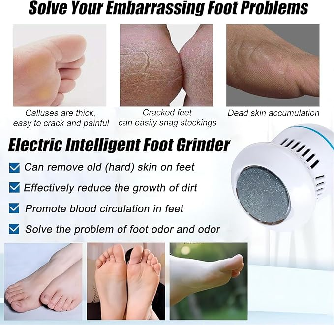 Electric Foot Grinder
