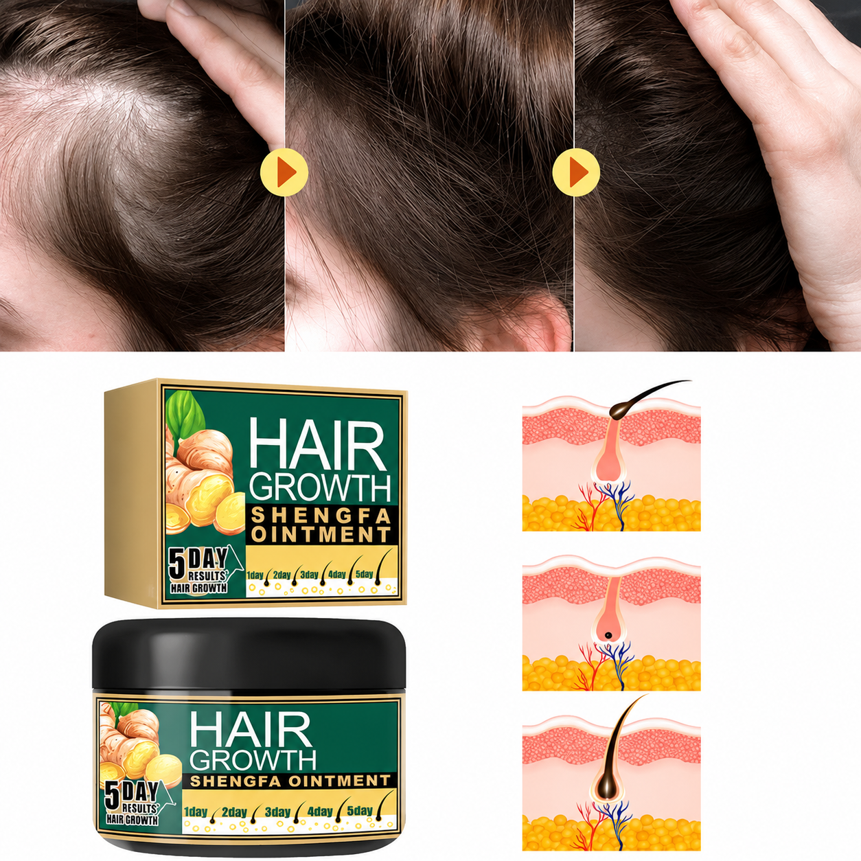 Ginger Hair Growth Cream With Natural Hair Loss Treatment Formula