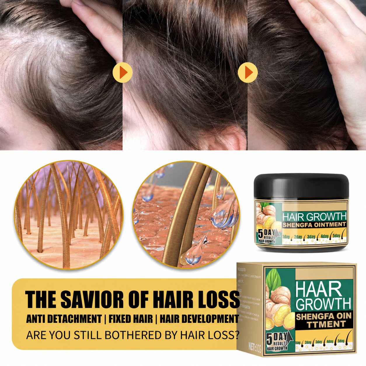 Ginger Hair Growth Cream With Natural Hair Loss Treatment Formula