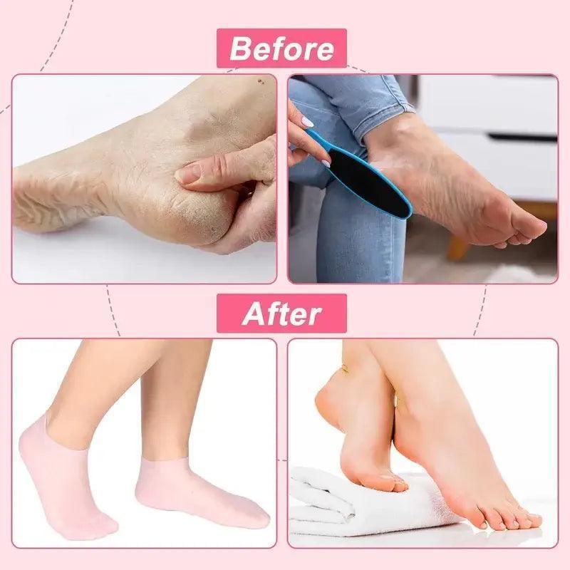 Slip Resistant Silicone Gel Socks – Deep Hydration for Dry Feet