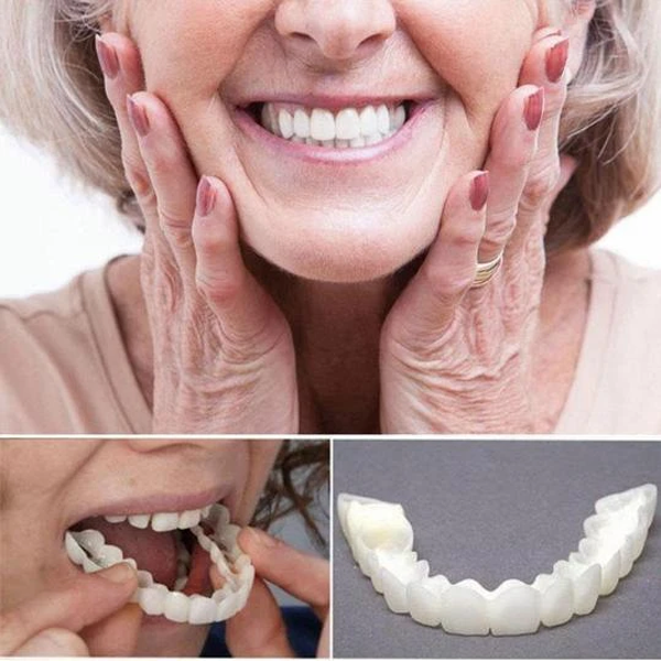 Perfect Smile Snap-On Braces-Viral Super Shop