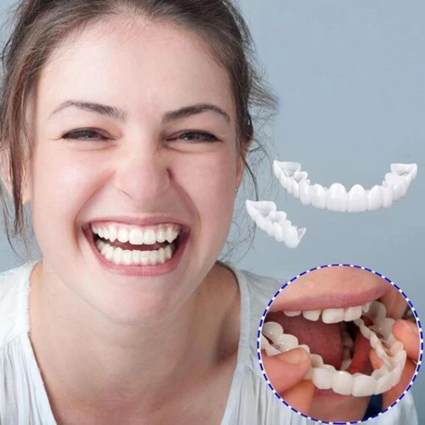 Perfect Smile Snap-On Braces-Viral Super Shop