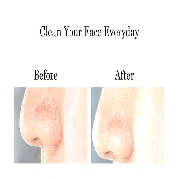 Dot Shape Face Brush - Cleanse Brighten And Smooth Skin-My Makeup Brushset