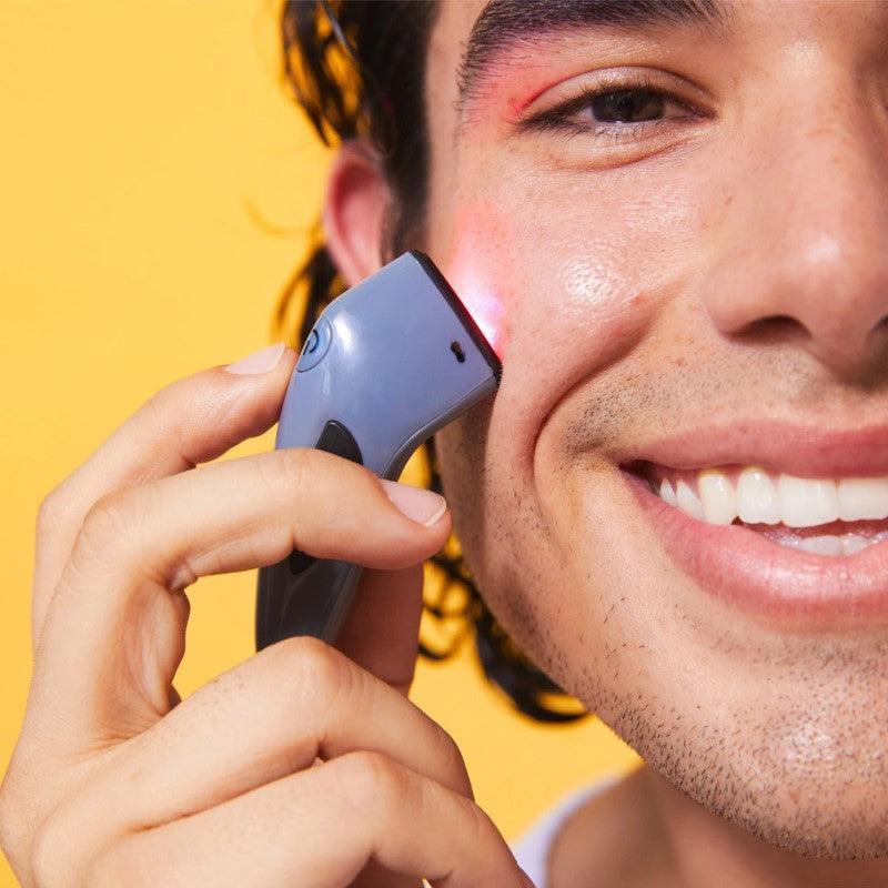 Acne Spot Treatment - Your Solution for Clear Skin-My Makeup Brushset