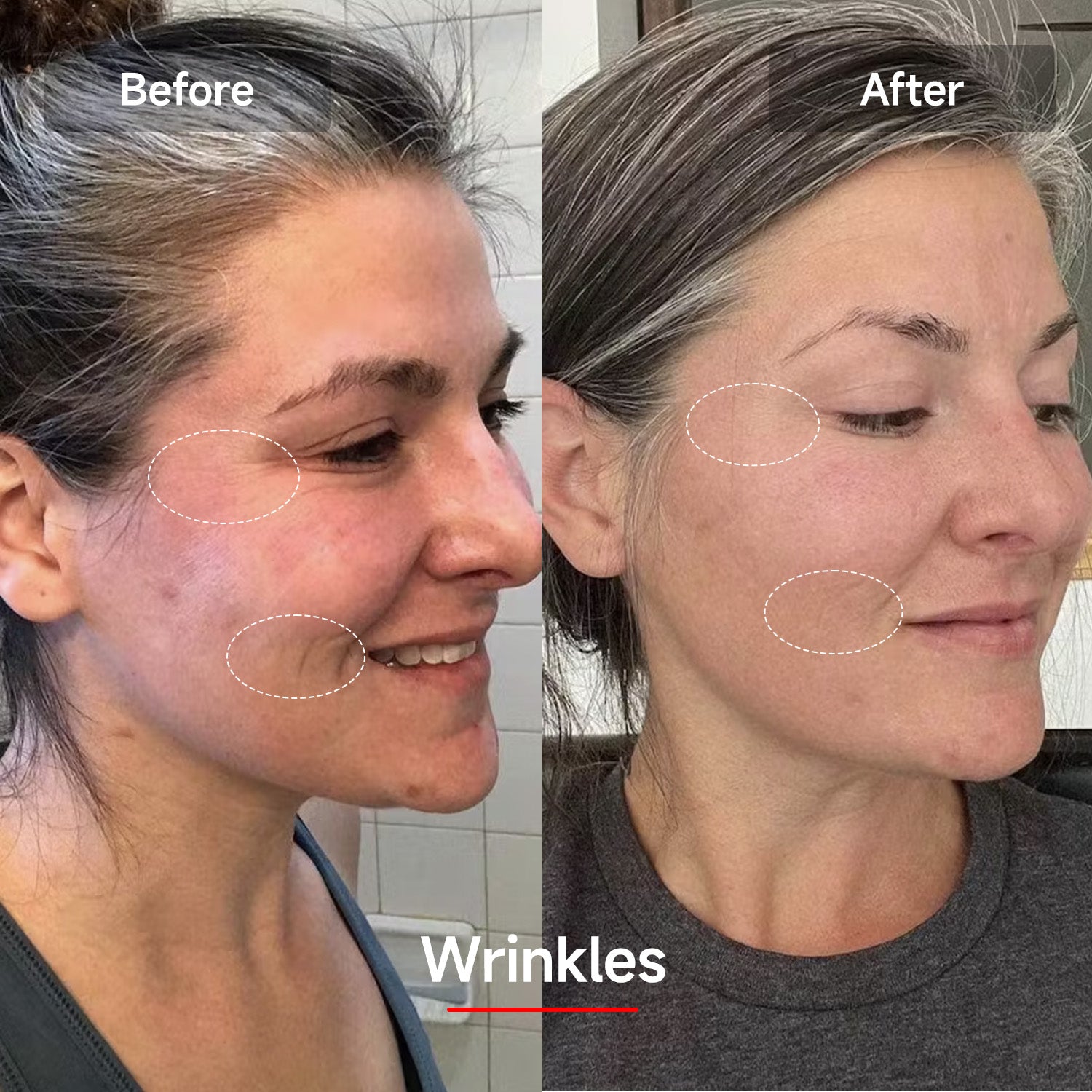 Veonskin LED Face Mask Pro – 7-Color Light Therapy for Skincare