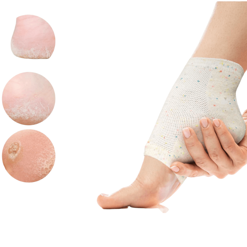 Moisturizing Gel Socks For Intensive Repair-Plantar Socks