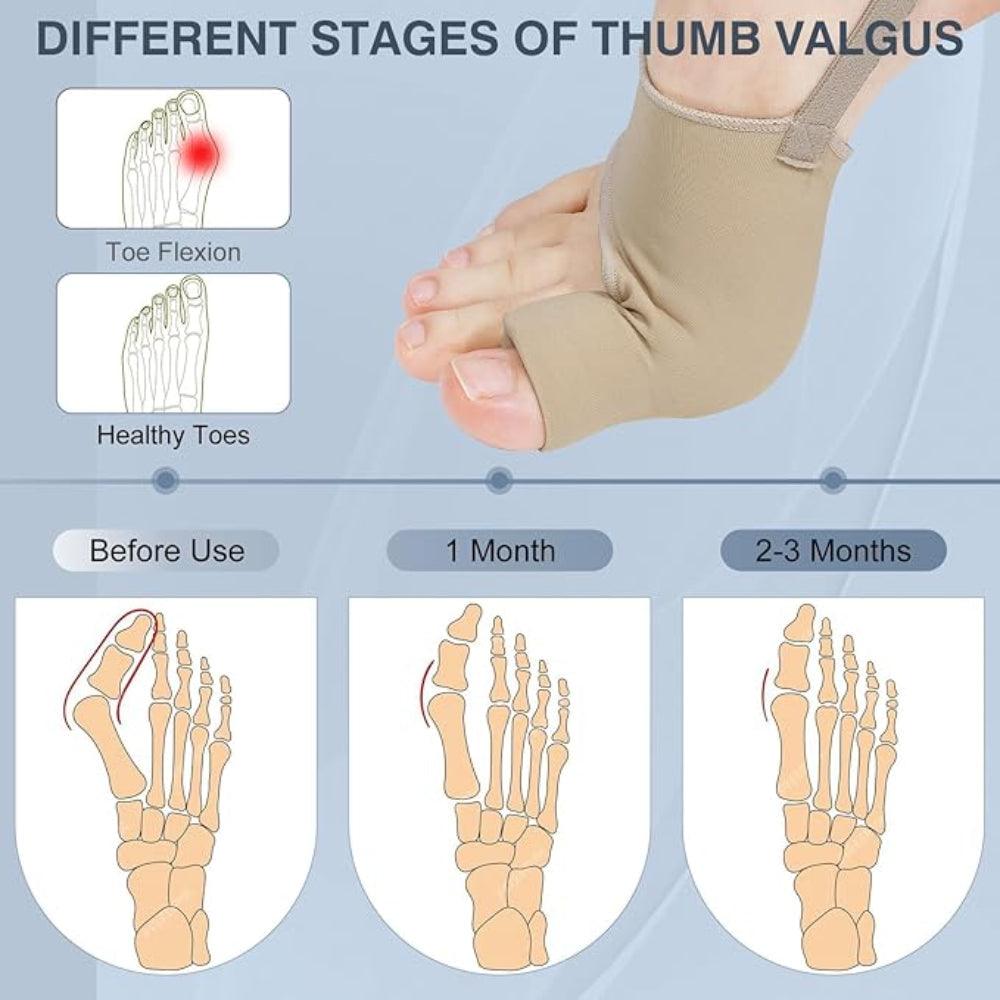 Orthopedic Toe Straightener Bunion Sleeve Socks For Relief And Alignment-Plantar Socks