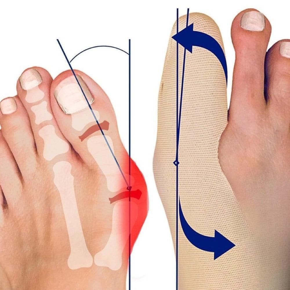 Ultra Thin Straightener Bunions Relief Socks-Plantar Socks