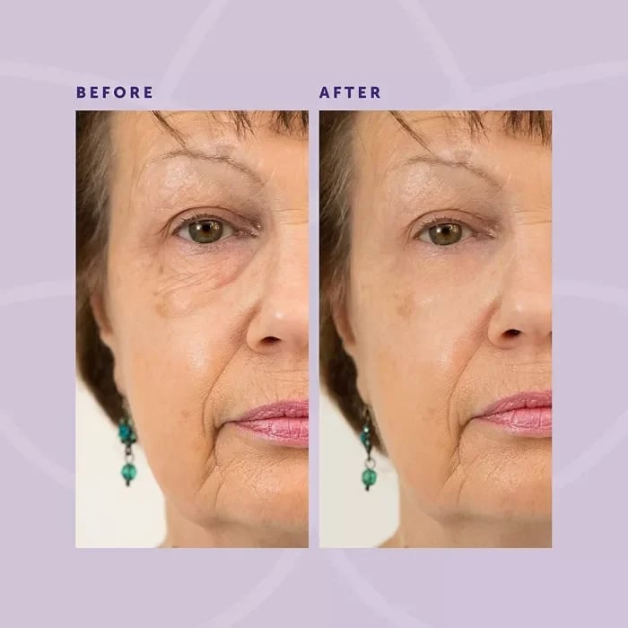 💆TEMPORARY FIRMING EYE CREAM