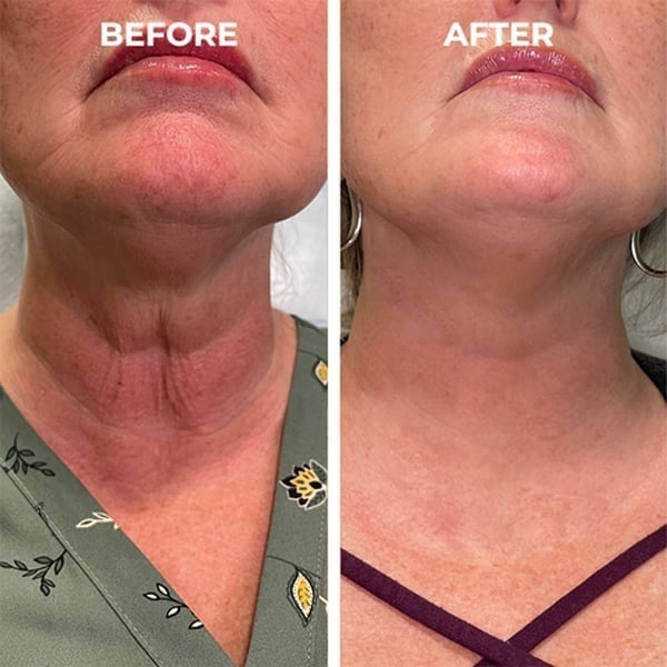 🔥BUY 2 GET 1 FREE-😍ANTI-AGING SERUM